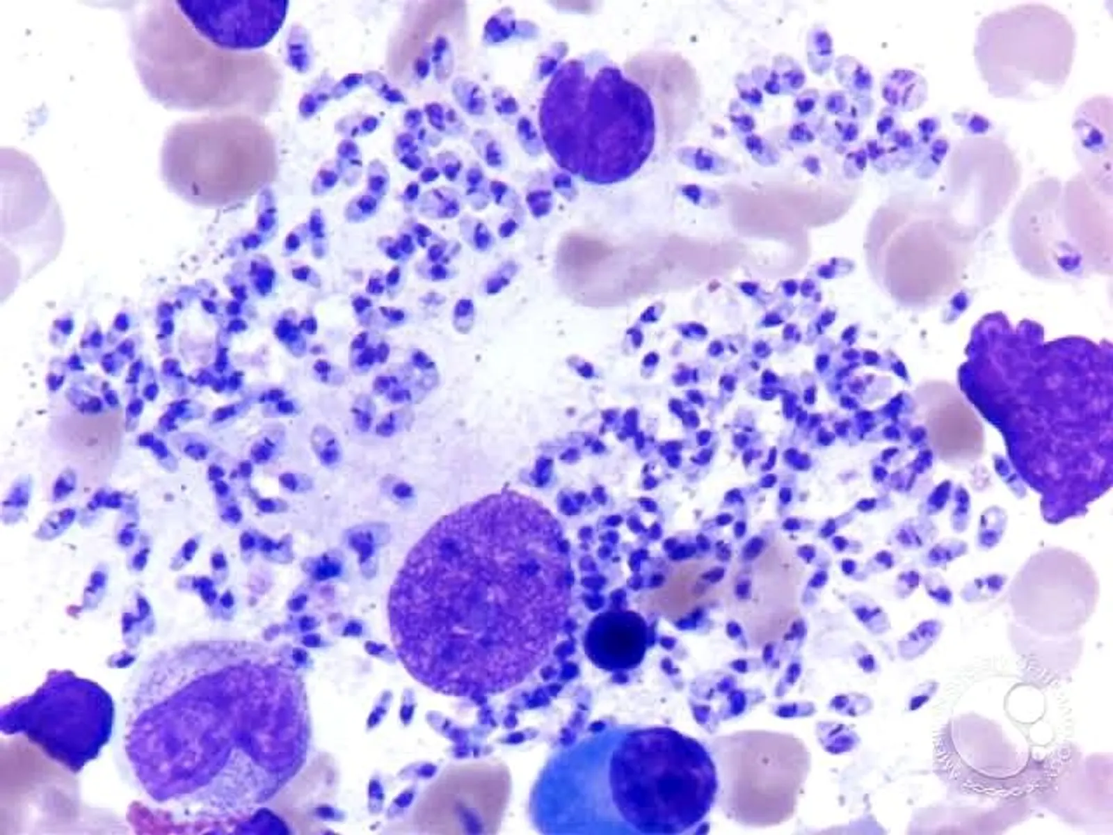 findings that differentiate histoplasma from leishmania: Leishmania is extracellular and intracellular