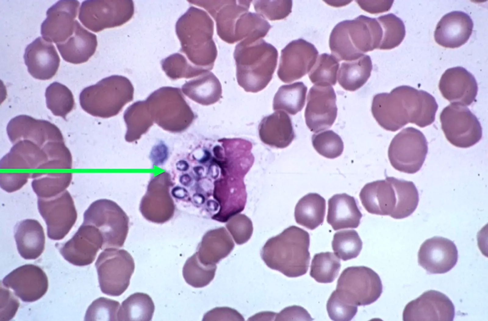 Histoplasma has a characteristic crescent shaped nucleus.(green arrow)