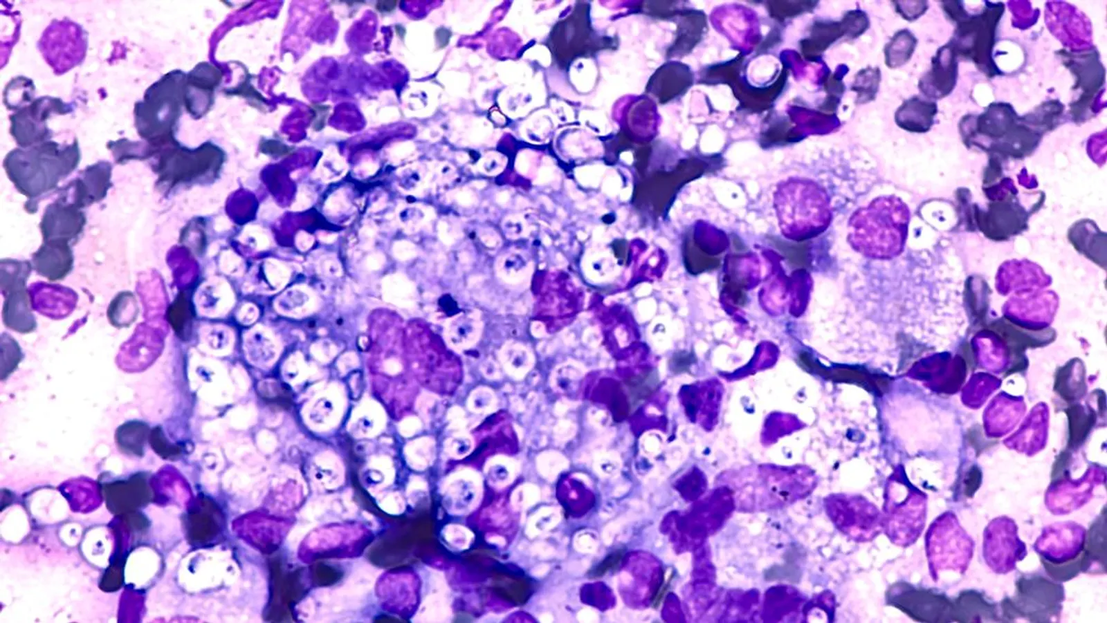Findings that differentiate Histoplasma from Leishmania