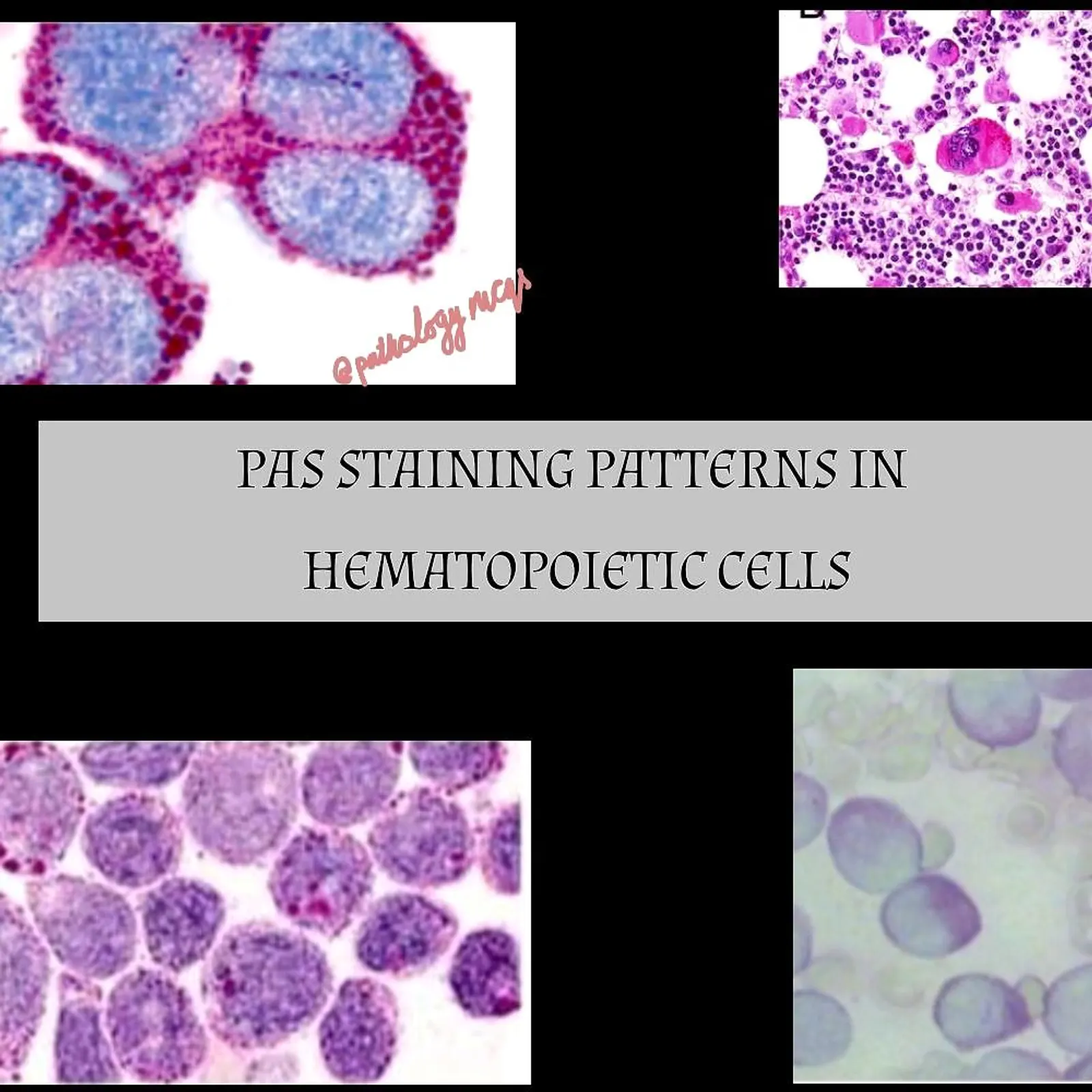 Periodic acid schiff (PAS)  staining patterns in hematopoietic cells