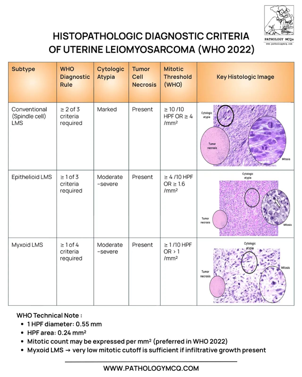 Composite histology image summarizing uterine leiomyosarcoma histopathology with cytologic atypia, tumor cell necrosis and mitotic activity.