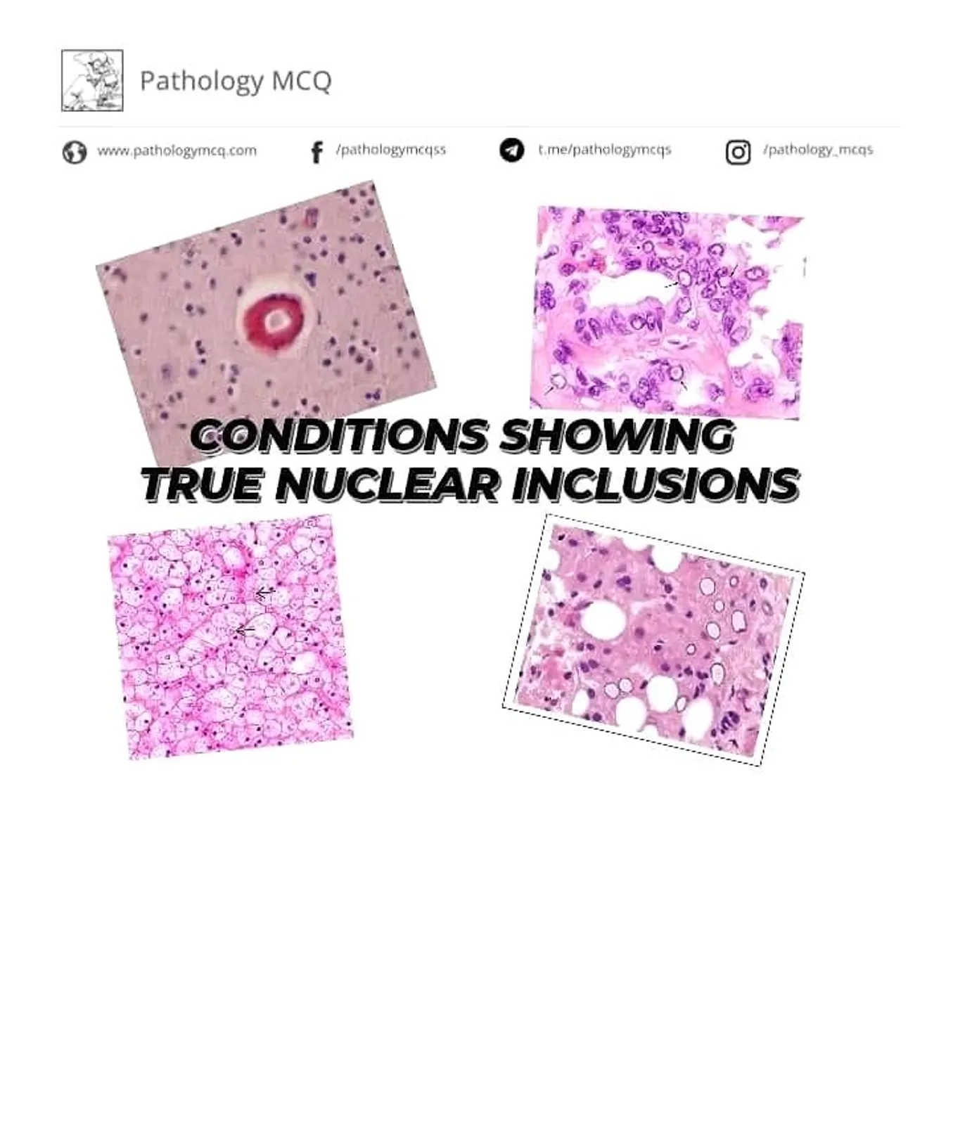 NUCLEAR INCLUSIONS AND PSEUDO-INCLUSIONS