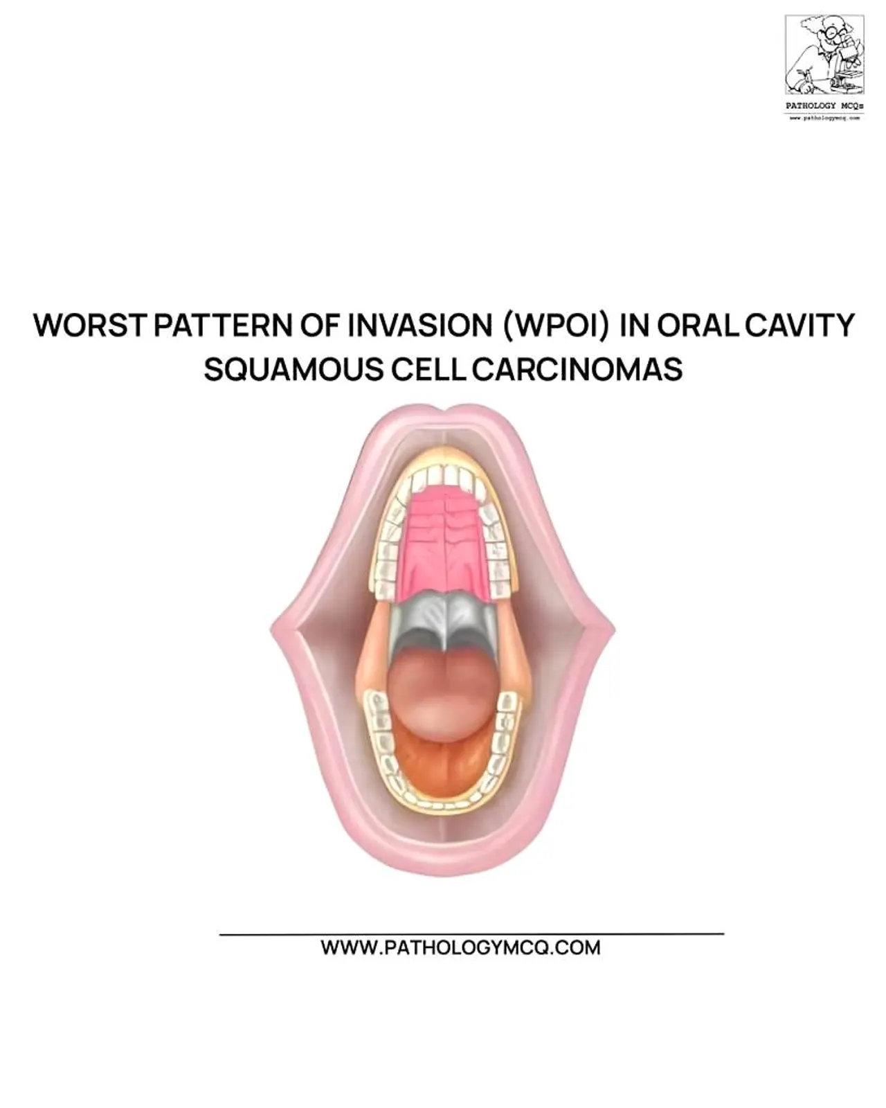 Diagram showing oral cavity region and site of invasion in OSCC.